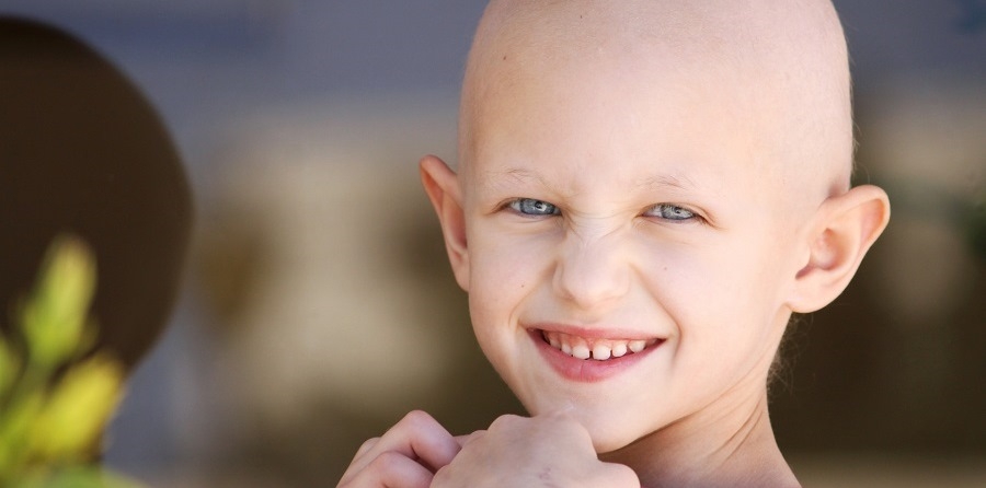 Alopecia areata ist häufig assoziiert mit weiteren Autoimmunerkrankungen